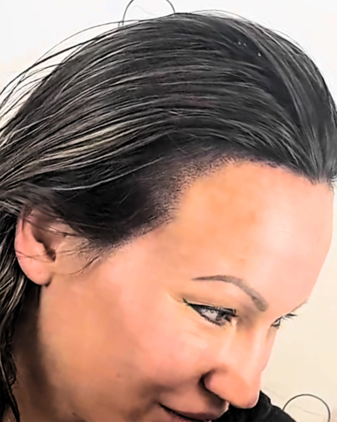 After Full Head SMP