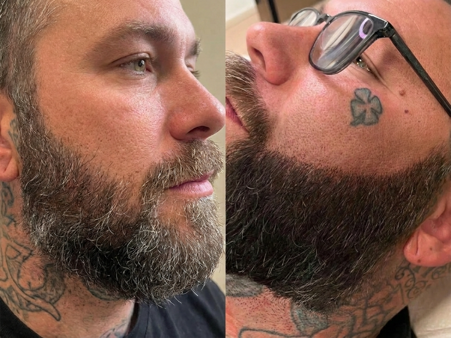 Beard SMP Result